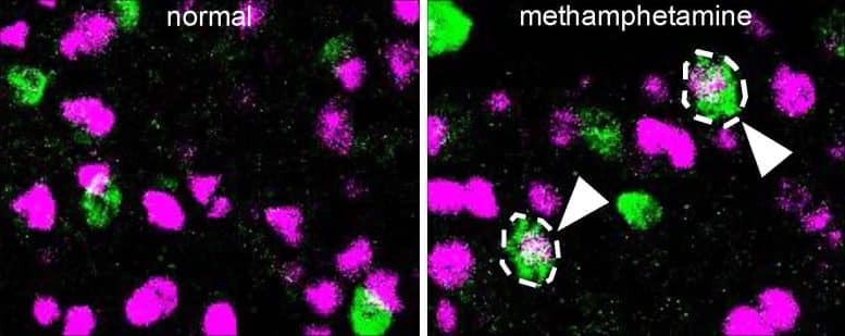 Neurônios alterados por drogas identificados na pesquisa